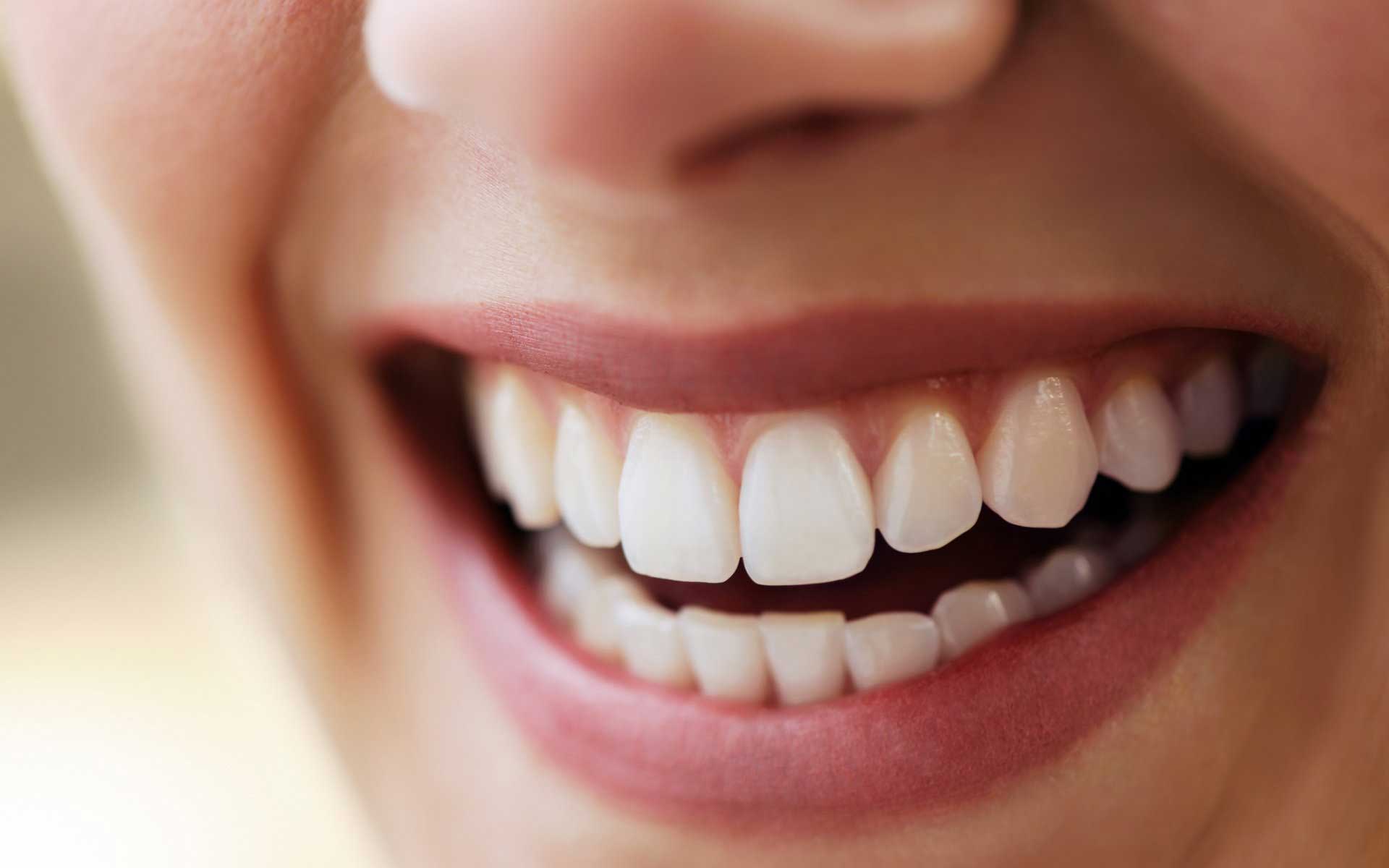 Faccette Per Denti Faccette Per Denti