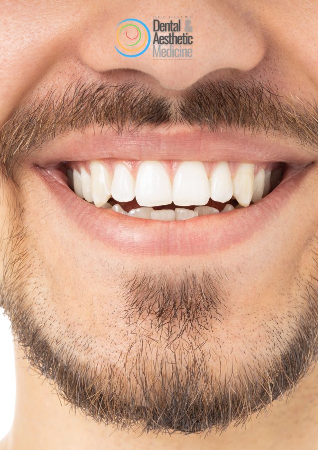 Parodontite Dentisti A Firenze 1 Parodontite Dentisti A Firenze 1